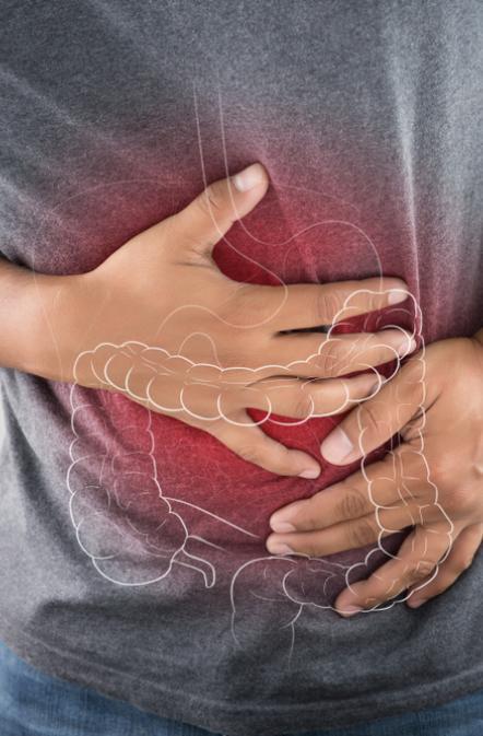 vignette irritable bowel syndrome vignette irritable bowel syndrome