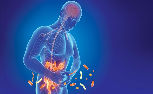Visuel syndrome intestin irritable